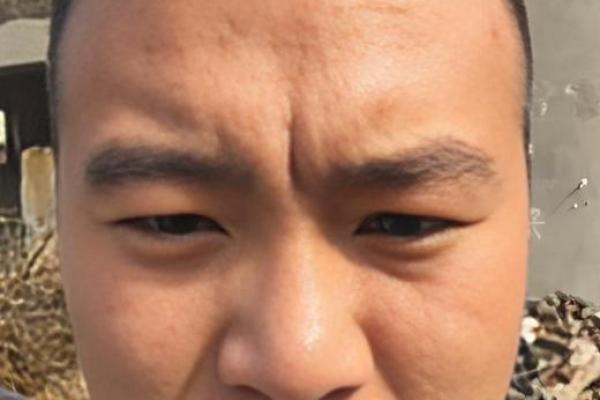 眉间八字纹，眉间两道竖纹代表什么