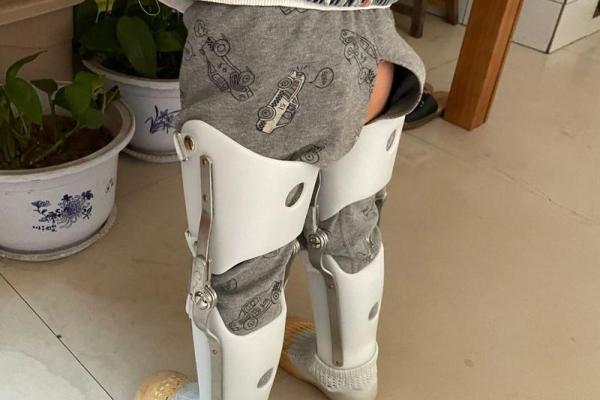 婴儿八字腿