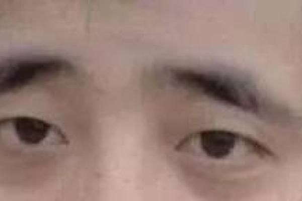 八字眉眉尾下垂的男人
