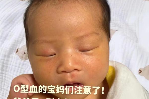 o血型稀有吗 O型血少见吗