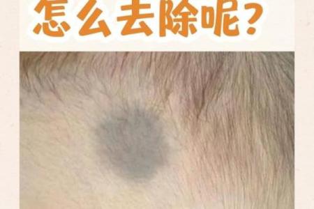 看胎记颜色类型算命