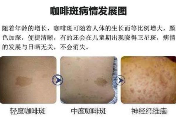 据脖子上胎记算命，有什么说法